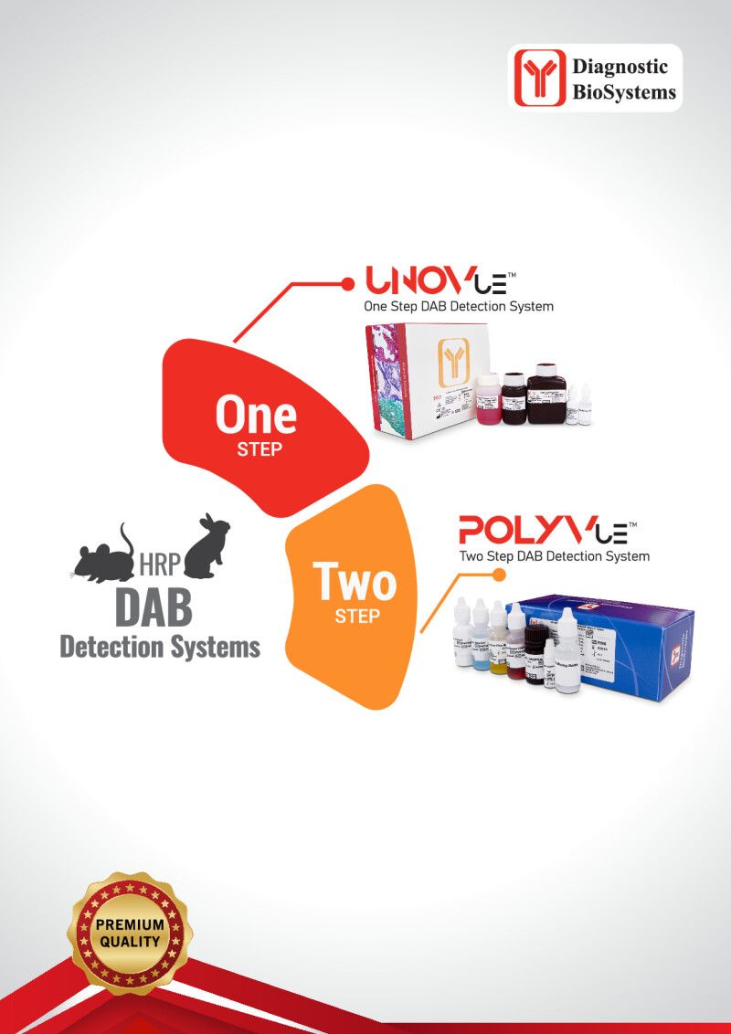 Dbs Dab Detection Systems