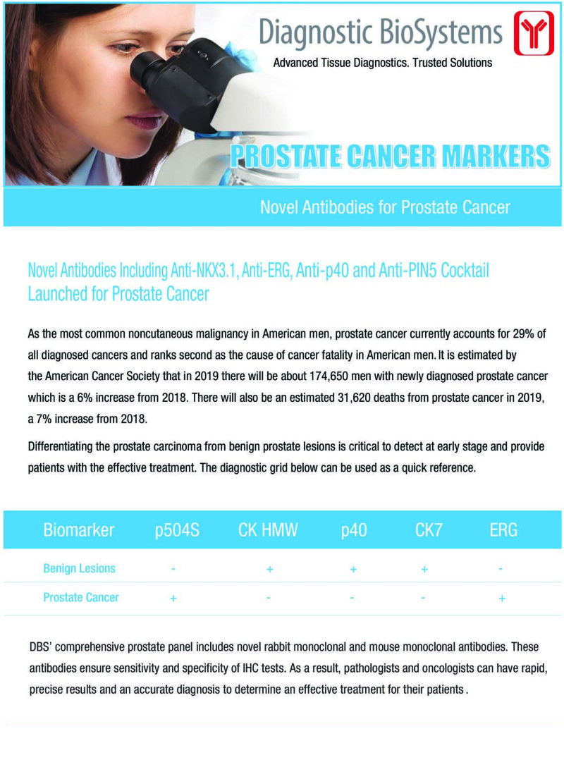 Dbs Prostate Cancer Markers